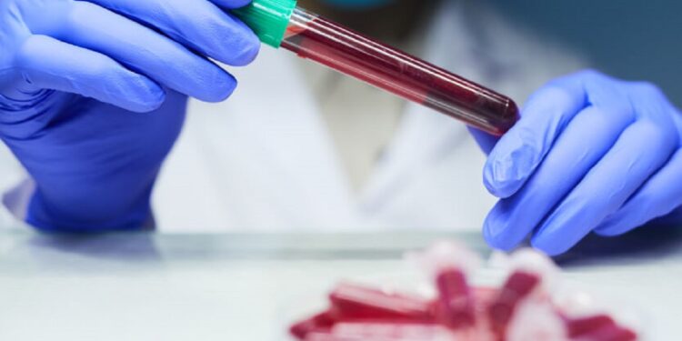 Las edades más afectadas son de 15 a 24 años