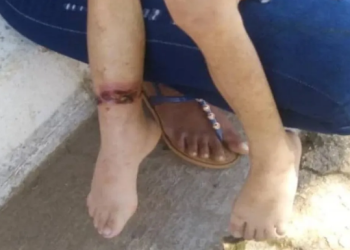 Autoridades encontraron a la niña encadenada a la pata de una cama