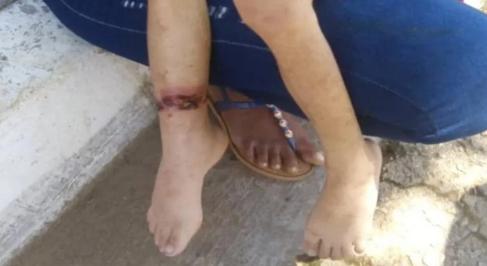 Detenida una mujer por encadenar y maltratar a su hija de seis años en Margarita 1 Autoridades encontraron a la niña encadenada a la pata de una cama