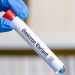 Registraron el primer caso de la subvariante Ómicron XE 11 Autoridades médicas piden estar alertas y cuidarse