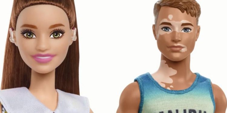 Mattel creó Barbie con audífono para discapacidad auditiva y Ken con vitiligo 1 Barbie discapacidad Ken vitiligo Foto Archivo