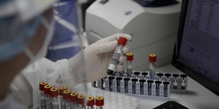 Argentina confirmó su primer caso de viruela del mono 1 Nuevo proyecto 2022 05 27T113358.408 1