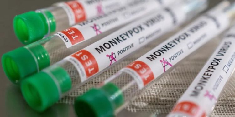 Panamá declara alerta sanitaria por viruela del mono 1 photo1653588190