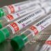 Panamá declara alerta sanitaria por viruela del mono 10 photo1653588190