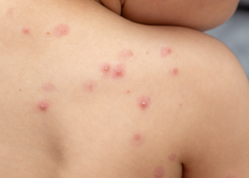 cf239de73bd34559aeb194db10dc12ce