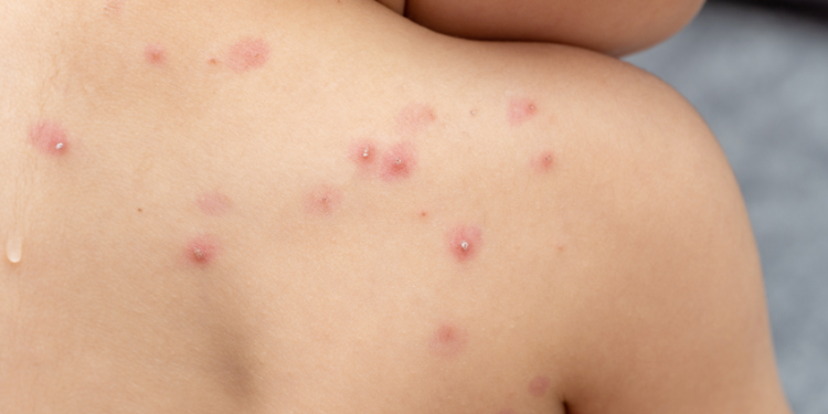 cf239de73bd34559aeb194db10dc12ce