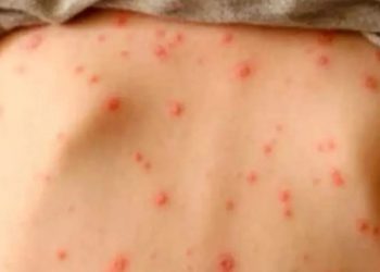 Autoridades de salud realizarán una jornada de vacuna masiva antes de comenzar las clases en el mes de septiembre